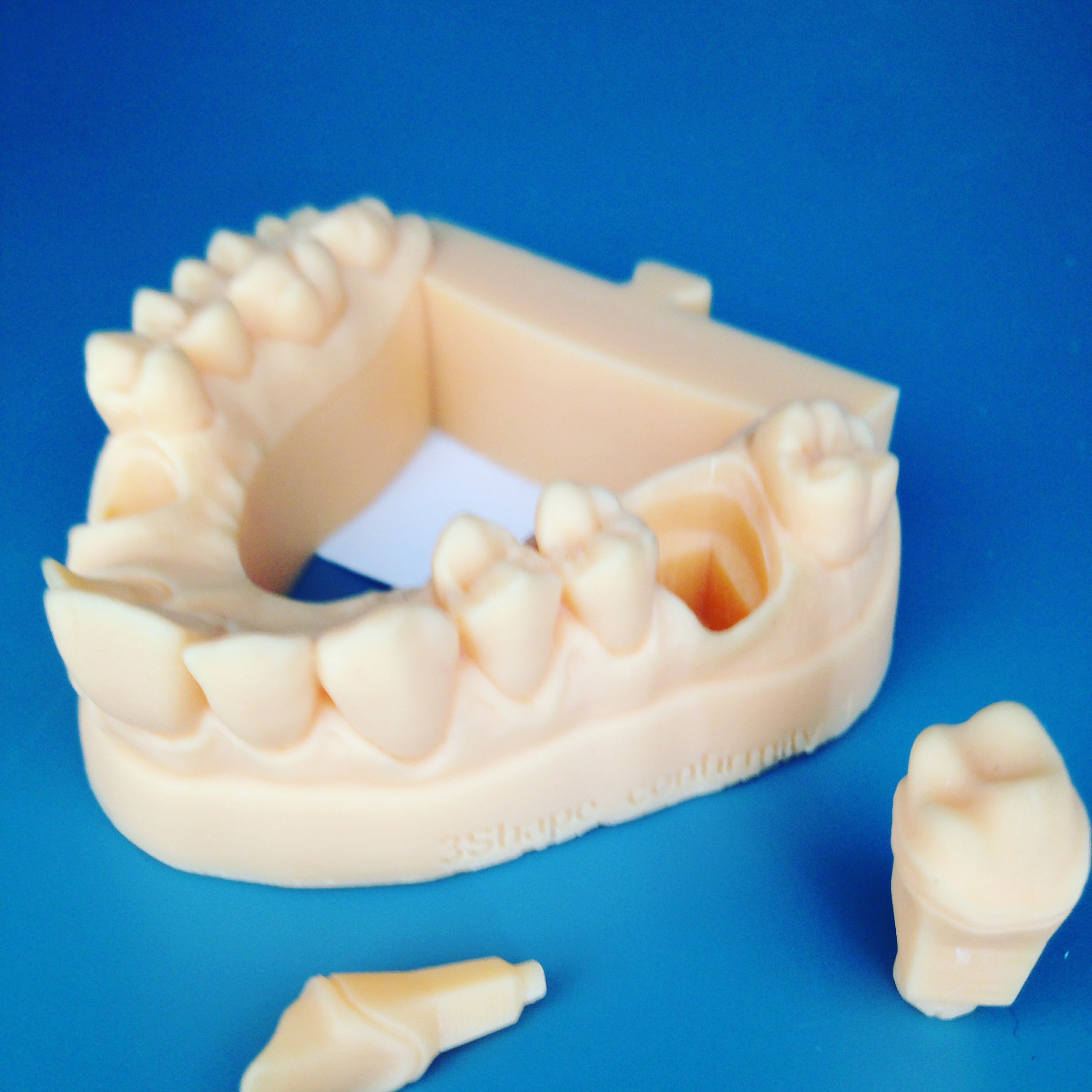 modello dentale - modello arcata dentale a monconi sfilabili